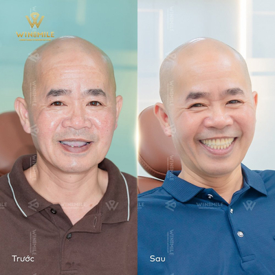 Slider image (1) WinSmile Dental Clinic Vietnam